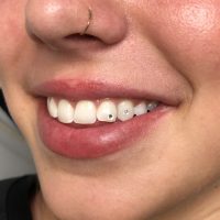 Tooth Gems Tooth gems done at Tiger & Rose Tattoo, London