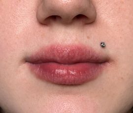 Medusa piercing