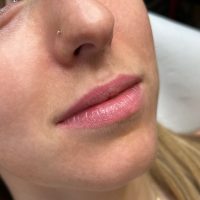 Healed lip lush tattoo done by Dana Depta Permanent Makeup, London