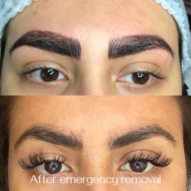 Emergency saline microblading removal done by Dana Depta Permanent Makeup, London