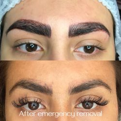 Emergency saline microblading removal done by Dana Depta Permanent Makeup, London