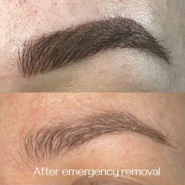 Emergency microblading saline removal done by Dana Depta Permanent Makeup, London