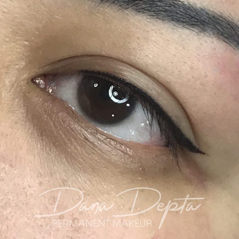 Emergency microblading removal London