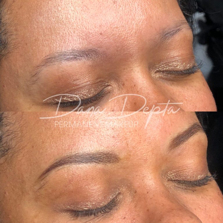 microblading removal London